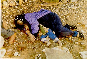 Le vittime kurde delle bombe irachene al Napalm nel 1988 sulla città kurda di Halabja.